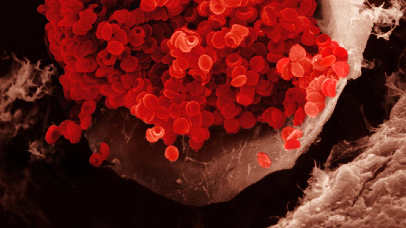 Rote Blutkörperchen in einem Blutgefäß. Erythrozyten haben eine bikonkave Form und stellen die grundlegende Form des Sauerstofftransports im Blut dar. REM X1000 (© Michael Webb/Visuals Unlimited, Inc.)(Bing Deutschland)