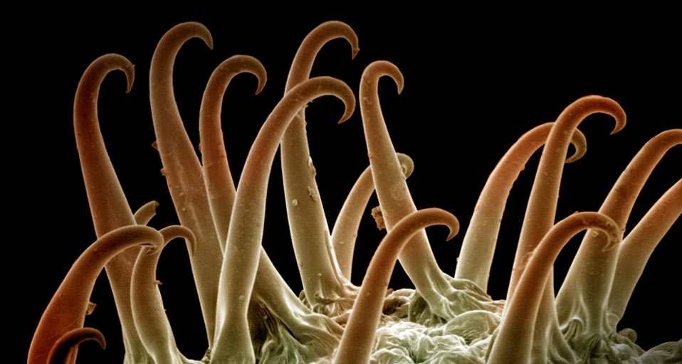 电子显微镜下的苍耳种子 -- Richard Kessel/Visuals Unlimited, Inc. &copy; (Bing China)