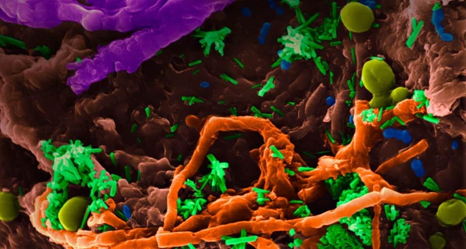 A variety of bacteria, yeast, and fungus on a kitchen sponge (© Dennis Kunkel Microscopy, Inc./Visuals Unlimited, Inc.) &copy; (Bing Canada)